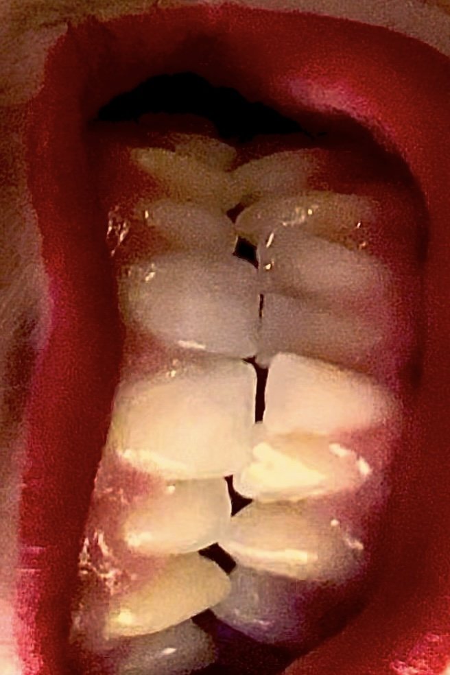 LIPS §§2